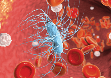 Know the Signs of Sepsis Quiz